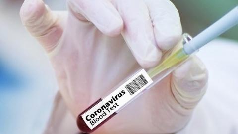 Koronawirus w Polsce: 12430 nowych przypadków zakażeń 1091 w Kujawsko-Pomorskiem